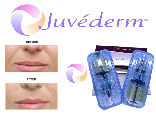 2x1ml de dwars Verbonden Huidvuller van Juvederm voor Gezichtsrimpel het Vullen
