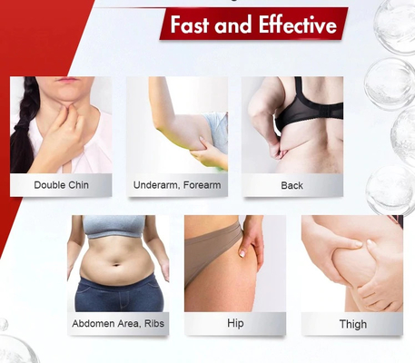 De Injectielipolysis van het gewichtsverlies Oplossing voor het Vette Oplossen