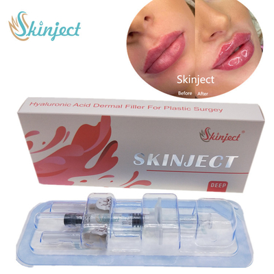 Injecteerbare Vullers van Skinject de Diepe Hyaluronic Zure Huid2ml Lippen