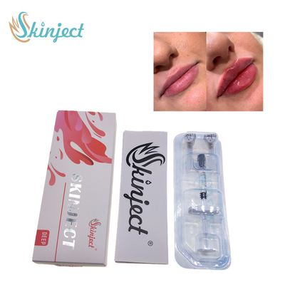 Injecteerbare Vullers van Skinject de Diepe Hyaluronic Zure Huid2ml Lippen