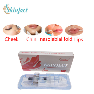 De injecteerbare van de Lippenvullers van Skinject Diepe Ha Huid2ml Wang Chin Nasolabial Fold