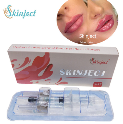 De injecteerbare van de Lippenvullers van Skinject Diepe Ha Huid2ml Wang Chin Nasolabial Fold