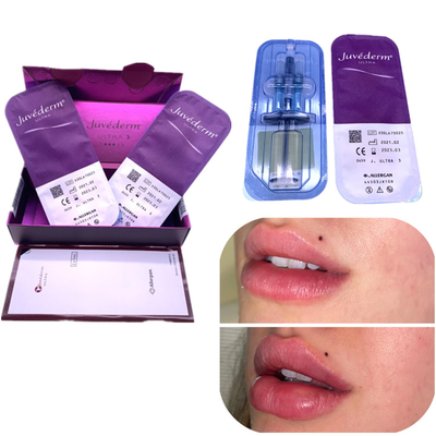Van de Vullerjuvederm 2x1ml van injectieha de de Lippenverhoging verwijdert Rimpels