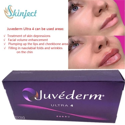 Van de Lippenvullers van de gezichtszorg 2x1ml Juvederm Hyaluronic Zure Huid Injecteerbaar