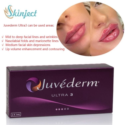 Van de Lippenvullers van de gezichtszorg 2x1ml Juvederm Hyaluronic Zure Huid Injecteerbaar