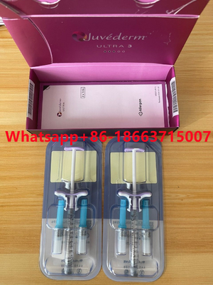Injectie van de Juvedermultra3 Ultra4 verwijdert de Huidvuller voor Lippenneus Rimpels