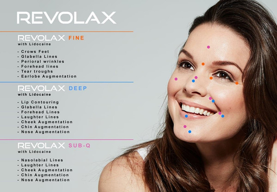 Vergroting van de Rimpelslippen van de Revolax Hyaluronic Zure Huidvuller