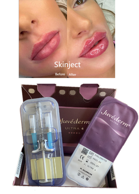 De injecteerbare Diepe Hyaluronic Zure Huid2ml-Wang Chin Nasolabial Fold van de Lippenvuller