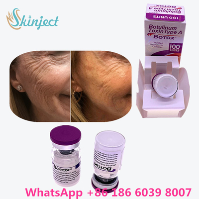 allergan botulinum toxine Anti het Verouderen Productentype A Toxine Antirimpel
