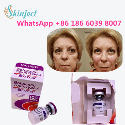 allergan botulinum toxine Anti het Verouderen Productentype A Toxine Antirimpel