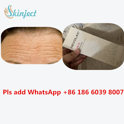 Injecteerbare Huidvuller Revolax 24 Mg/ml Hyaluronic Zure Injectie van Ha
