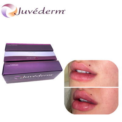 Injecteerbare Huidvuller Ultra3 Ultra4 Voluma voor Jukbeenlip