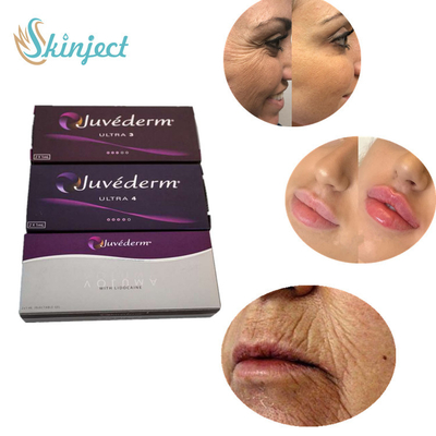 2 Dwars Verbonden Hyaluronic Zure Vuller ultra 3 ultra 4 Voluma van ml Juvederm