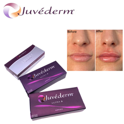 Hyluronzuur huidvuller Premium Juvederm HA Gezichtsvuller Ultra3 Ultra4 Voluma Voor gezichtsverjonging