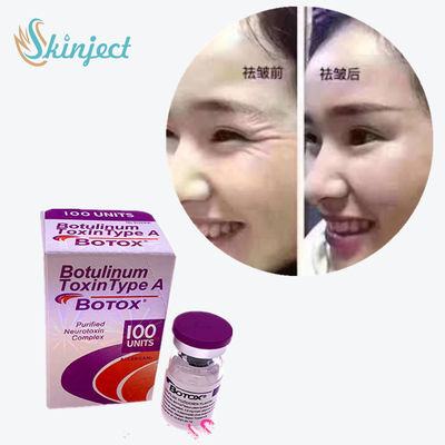 100 Eenheden Type A Botulinum Toxine 2 - 8°C-Opslagtemperatuur