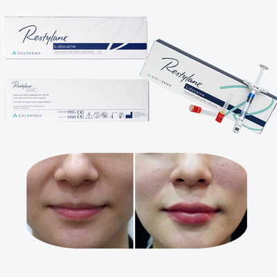 Vital  Perlane Cross Linked Dermal Filler Hyaluronzuur Lyft Dermal Fillers