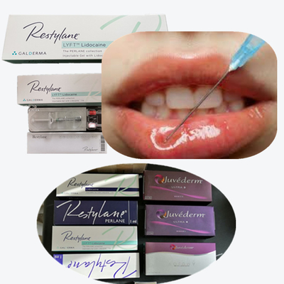 Dermale vulmiddel Lip Injecties Koreaanse originele authentieke producten Lip Natrium Hyaluronate Filler