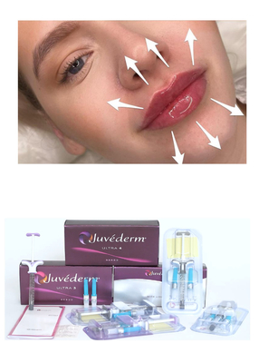 Juvederm' Hyaluronezuur Dermale Filler Ultra3 Ultra4 Voluma Injectie Voor Lip Filling