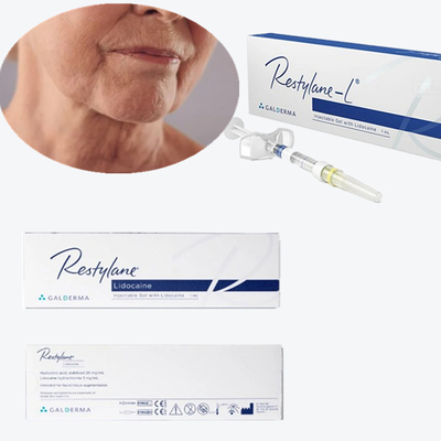 Cosmetische cross-linked dermale filler HA injectie voor mondhoeken