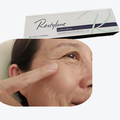 Hyaluronidase-oplossing Cross Linked Dermal Filler HA Injectie voor neuslijnen