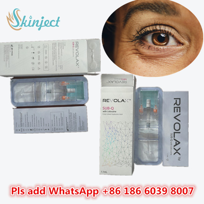Medisch natriumhyaluronate gel Hyaluronzuur Dermale Revolax Diepvuller 1 ml Voor Lippen Injectie