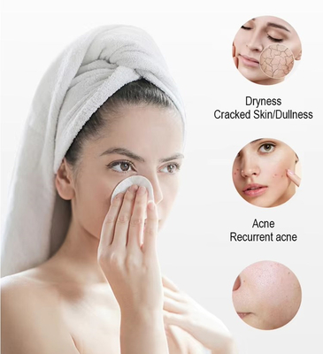 Nieuwe aankomst Black Pearl 10 in 1 Hydra Peeling Machine Microdermabrasie Machine Gezichtsspa Micro-Touch Hydra Huidverzorging