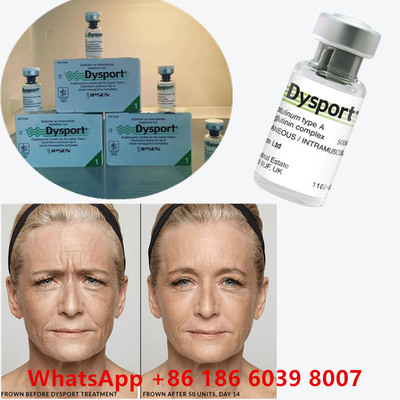 Botulinumtoxin 100 Eenheden BTX Injectie Type A Cosmetisch gebruik