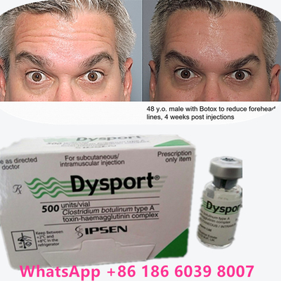 Botulinumtoxin 100 Eenheden BTX Injectie Type A Cosmetisch gebruik