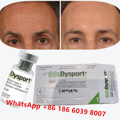 Botulinumtoxin Dysport Clostridium Botulinum type A Voor kraaienpootjes