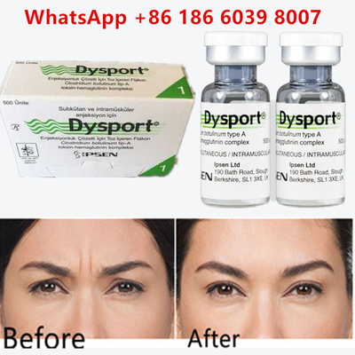 Botulinum Toxin Dysport 100u Clostridium Botulinum Type A Voor voorhoofdrimpels