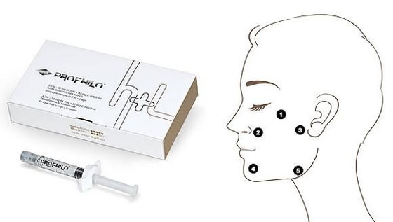 Collageenstimulatie Profhilo injecteerbare huidvuller Vijfpuntslifting