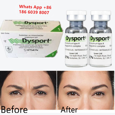 Botulinetoxine A Dysport Injecteerbaar Botox Voor Kinvergroting