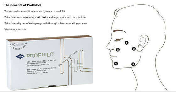 2 ml Cross Linked Dermal Filler PROFHILO Anti-aging huidbehandeling Gezicht wit Effectief voor huidverjonging