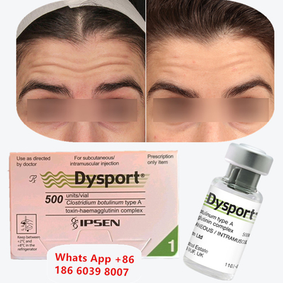 Botulinum Toxin A Dysport Botox Injectie Voor Lip Lines