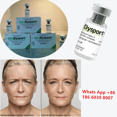 Dysport 500u Botulinum Toxin Type A voor wangvergroting