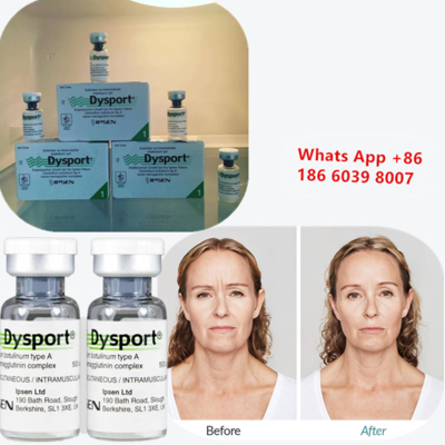 Botulinumtoxine type A Dysport injectie voor rimpelvermindering
