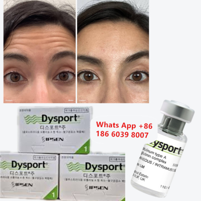 Dysport Botulinum Toxin type A voor frons en glabellijnen