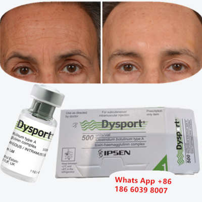 Dysport Botulinum Toxin type A voor frons en glabellijnen