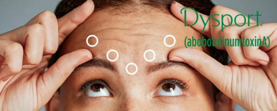 Dysport 500 voor injectie AbobotulinumtoxinA Botox 500U