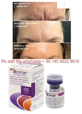Allergan Botox 100IE Dysport Injectie Botulax Botuline Toxine Rimpels Verwijderen