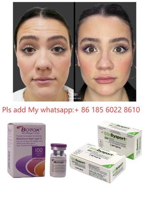Botulinetoxine Allergan Botox 100IE voor rimpelvermindering en cosmetisch