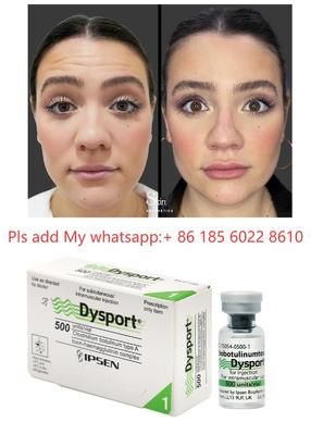 Dysport 500iu Injectie Anti-Rimpel Botulinetoxine Allergan Botulax