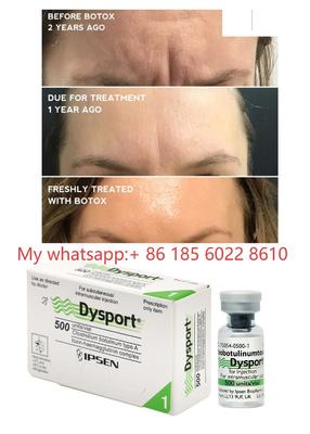 Dysport 500IE Injecties Botulinetoxine Allergan Botulax - Verzacht Fijne Lijntjes en Rimpels