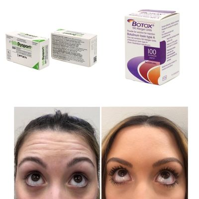 100 Eenheden Korea BTX Botulinum Toxin voor rimpels en fijne lijnen
