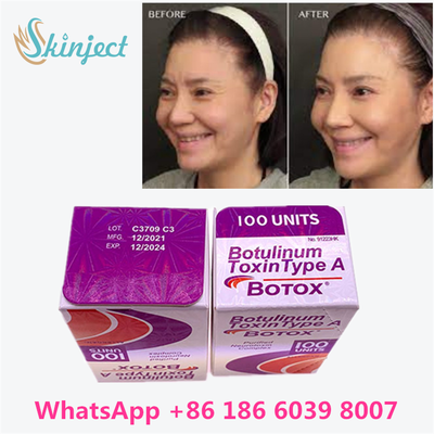 Botulinum Toxin Medical-Grade Botulinum Toxin For Aging Treatment at Home