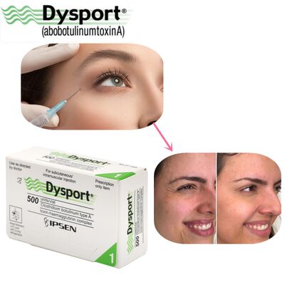 500u Dysport Gezichtsrimpel Verwijdering Vriesgedroogd Poeder Verwerking Custom OEM Dysport