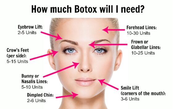 Schoonheidssalon allergeen Korea Botulinum Toxin Voor anti-aging en rimpelverwijdering