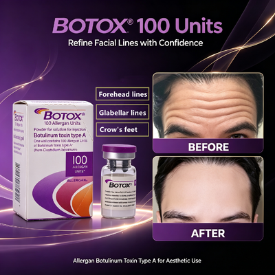 BOTOX 100 eenheden Anti-rimpel Injectie Gezichtsverzorging Allergeen Botulinum Toxin Type A