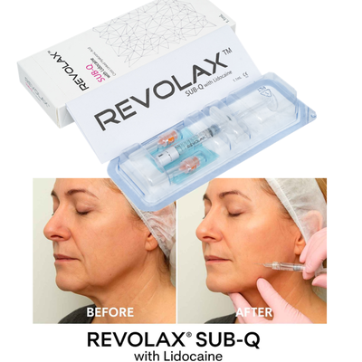 OEM 1.1ml Revolax Fine Deep Sub-Q Lichtgewicht Dermal Filler voor Fijne Lijnen en Subtiele Huidverjonging