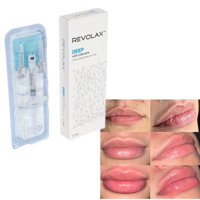 Revolax Hyaluronzuur Dermale vulmiddel Natuurlijke dikke lip Vergroting Gezichtsvolume Herstel